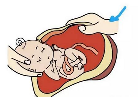 顺产与剖宫产知识分享,关于麻醉科剖宫产的知识宣教