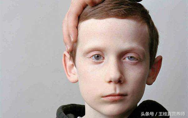 晚上洗头发容易引起偏头痛吗,晚上洗头发着凉头痛咋办