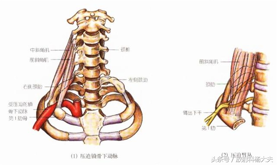 中年男人脖子长包并有一条沟,中年男性脖子后面有大包