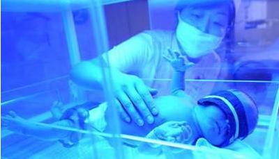 出生9天的宝宝黄疸,新生儿10多天才出现黄疸