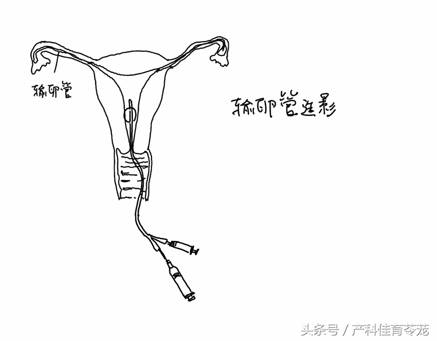 男生怀不上孩子怎么办,怀不上孩子怎么办视频