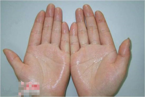 如何有效的抑制手掌出汗,手心容易出手汗怎么办