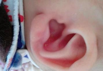 宝宝退烧后拒奶,宝宝洗完澡后发烧哭闹不止