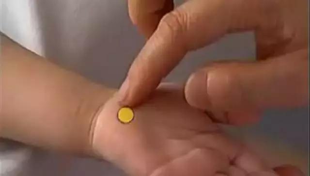 孩子湿疹怕用药有激素,不妨试试这几个穴位