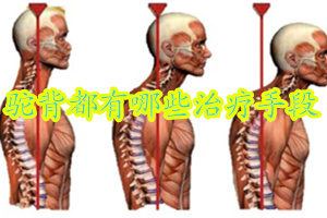 有什么治疗驼背的方法,比较严重的驼背怎么治