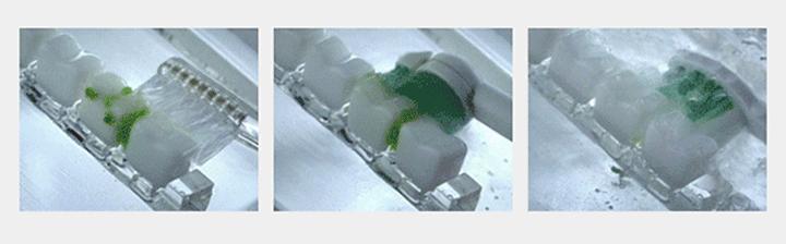 电动牙刷刷牙真的比一般牙刷好吗,刷牙是电动牙刷好还是普通的好