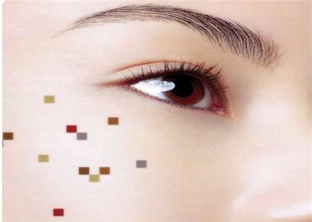 一女子回顾在美容院祛斑有多坑,女子点痣后查出恶性肿瘤