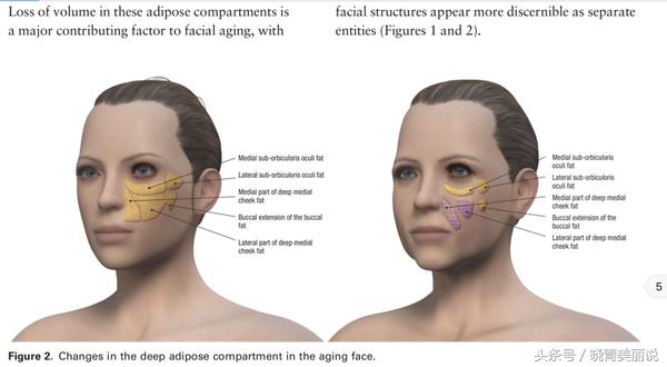孩子刚出生就有法令纹,15岁小孩为啥有法令纹