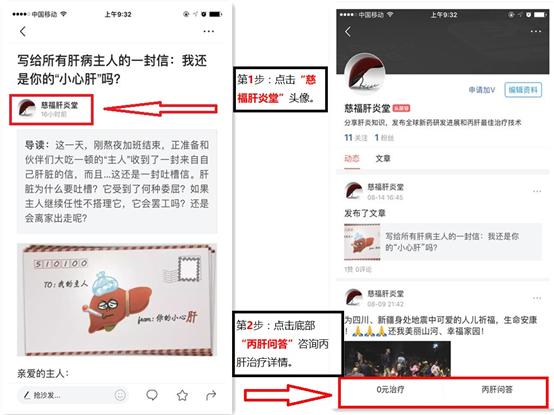 目前治疗急慢性丙肝最有效的方法,丙肝50严重吗