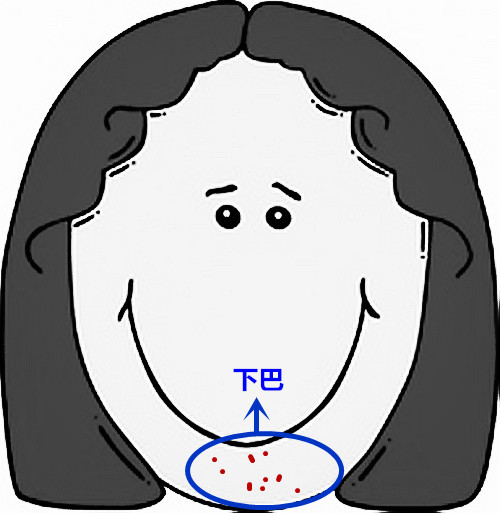 超级齐全的痘痘护理，有痘痘的妹子抓紧收藏