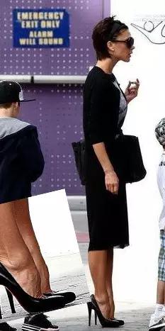 贝克汉姆老婆脚外翻,贝克汉姆老婆的脚拇外翻