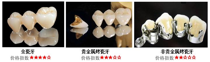 义齿怎么辨别真假,学会三招让你远离伪劣义齿