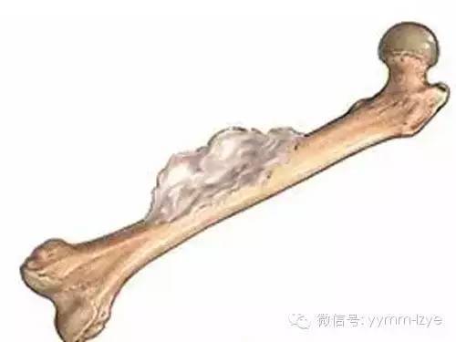 孩子腿疼不能弯曲怎么回事,孩子腿疼不一定是长个子