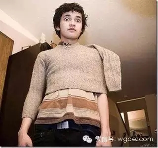 毛衣粘毛起球怎么处理,黑毛衣粘毛怎么彻底解决