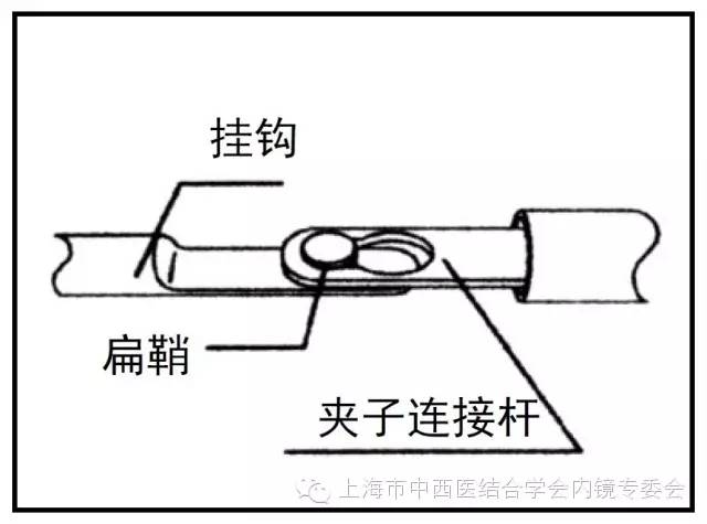 消化内镜护理配合教学视频,消化内镜取样钳