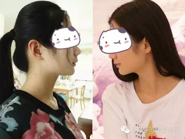 她们说||那些年整牙吞下的血和泪,终于换来最开怀的大笑