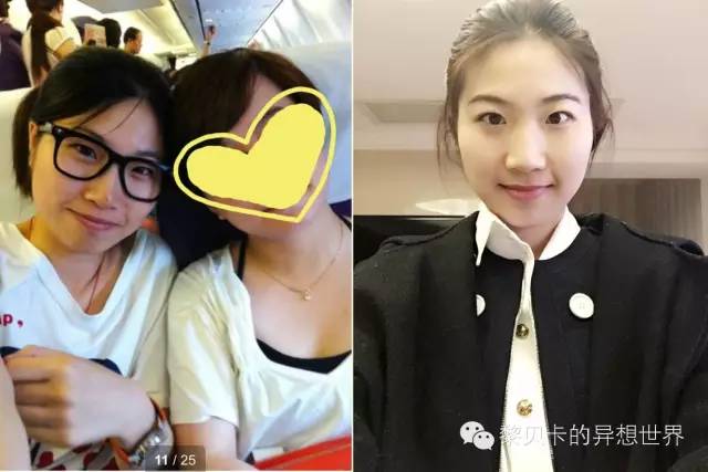 她们说||那些年整牙吞下的血和泪,终于换来最开怀的大笑