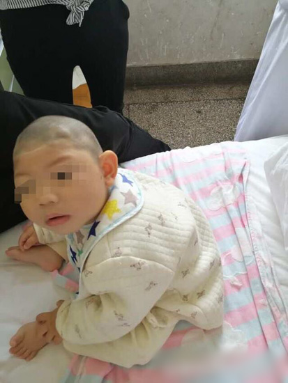 孩子个头偏小看医生有没有用,给宝宝检查头部必须去儿童医院吗