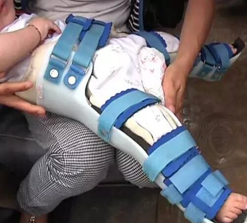 奶奶为了面子竟对半岁宝宝这样做,听了医生的话后十分后悔!