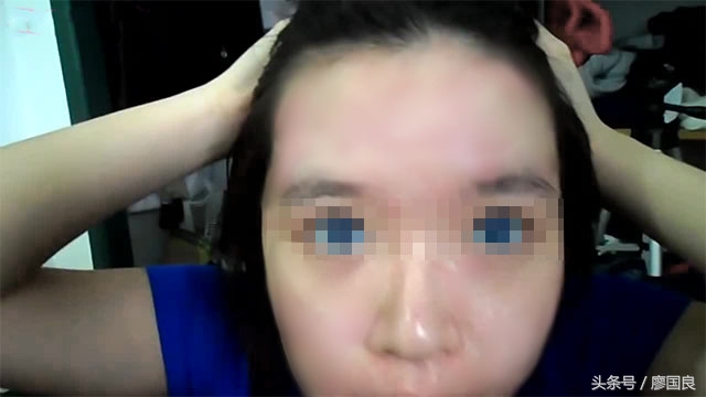 所有祛痘产品都会先爆痘吗,祛痘护肤品安全吗