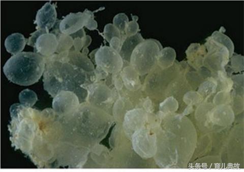 肚子越来越大胎动会越来越明显吗,突然觉得肚子变大胎动减少的原因