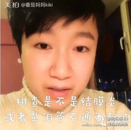 宝宝眼睛都是眼屎粘住了,宝宝眼睛被黄色眼屎糊住