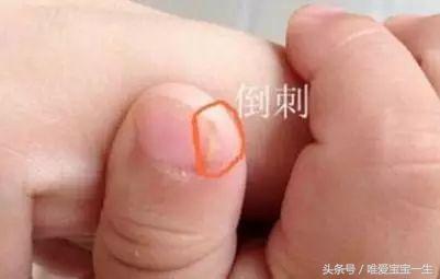 宝宝缺锌怎么办看完这些十分受益,如何自测周岁宝宝缺锌缺铁