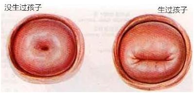 4招教你看出女人生过孩子,判断女人生过孩子最简单方法