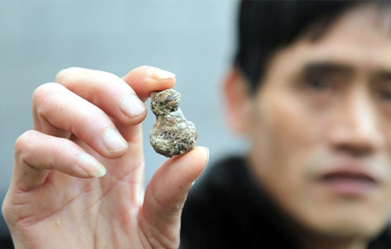 怎样知道自己得了草酸结石,如何知道自己的肾结石是草酸结石