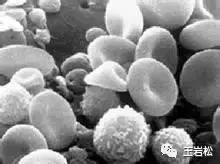 骨折术后怎么长得快,骨折为什么长得那么慢