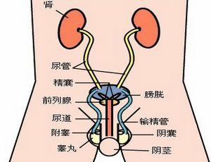 怎样知道自己得了草酸结石,如何知道自己的肾结石是草酸结石