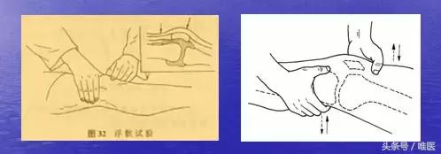 普拉提膝盖交叉韧带损伤康复训练,膝关节前交叉韧带损伤康复训练
