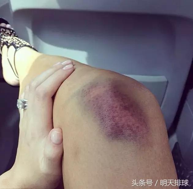 排球经典时刻回忆,排球十周年回忆