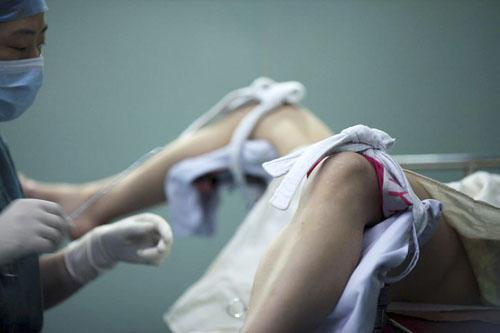 人流最全常识是什么,人流面临的四大常识问题