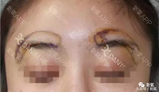 杨紫瘦了腿显得不纤细,杨紫变美之路脸怎么瘦的