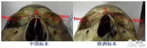 杨紫瘦了腿显得不纤细,杨紫变美之路脸怎么瘦的