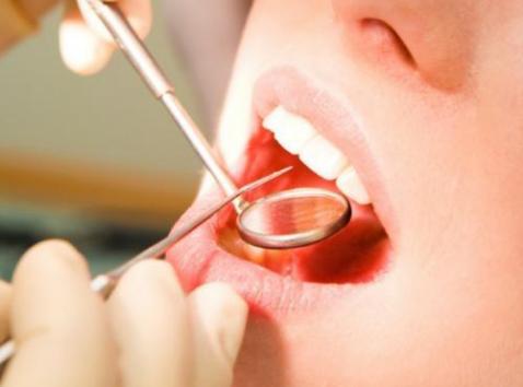 牙周炎中医治疗方法,牙齿牙周炎怎么治疗