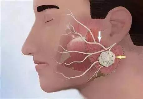 左眼皮跳是跳灾还是跳财,眼皮跳是跳财还是跳灾