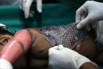 鱼的这个部位千万别吃毒性超强,用鱼皮治烫伤真的可能吗