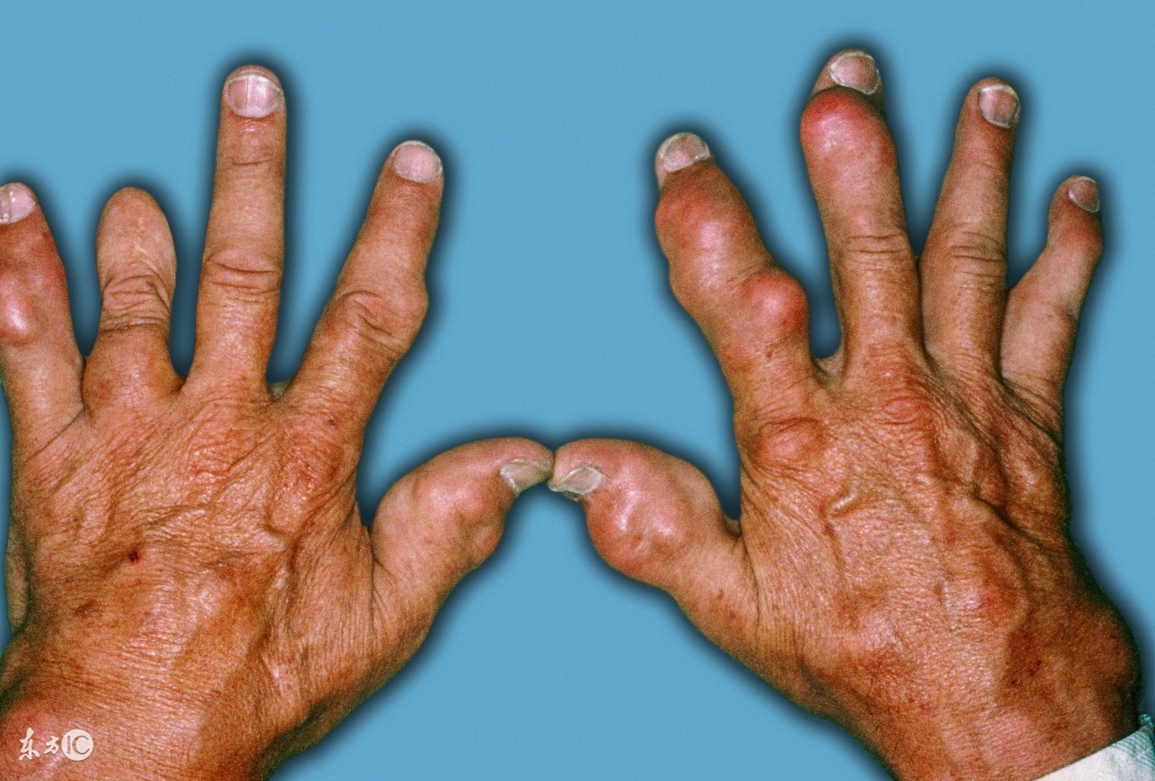 为什么不能只吃海鲜,吃海鲜的常识和禁忌你都知道吗