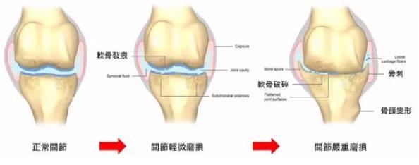 全国最好的治骨关节炎的医院,关节炎医院十大排名