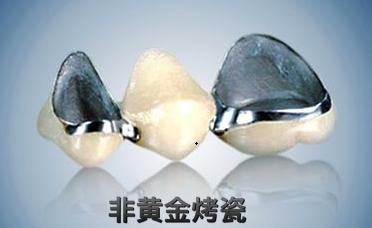 真正的烤瓷牙,烤瓷牙的真实感