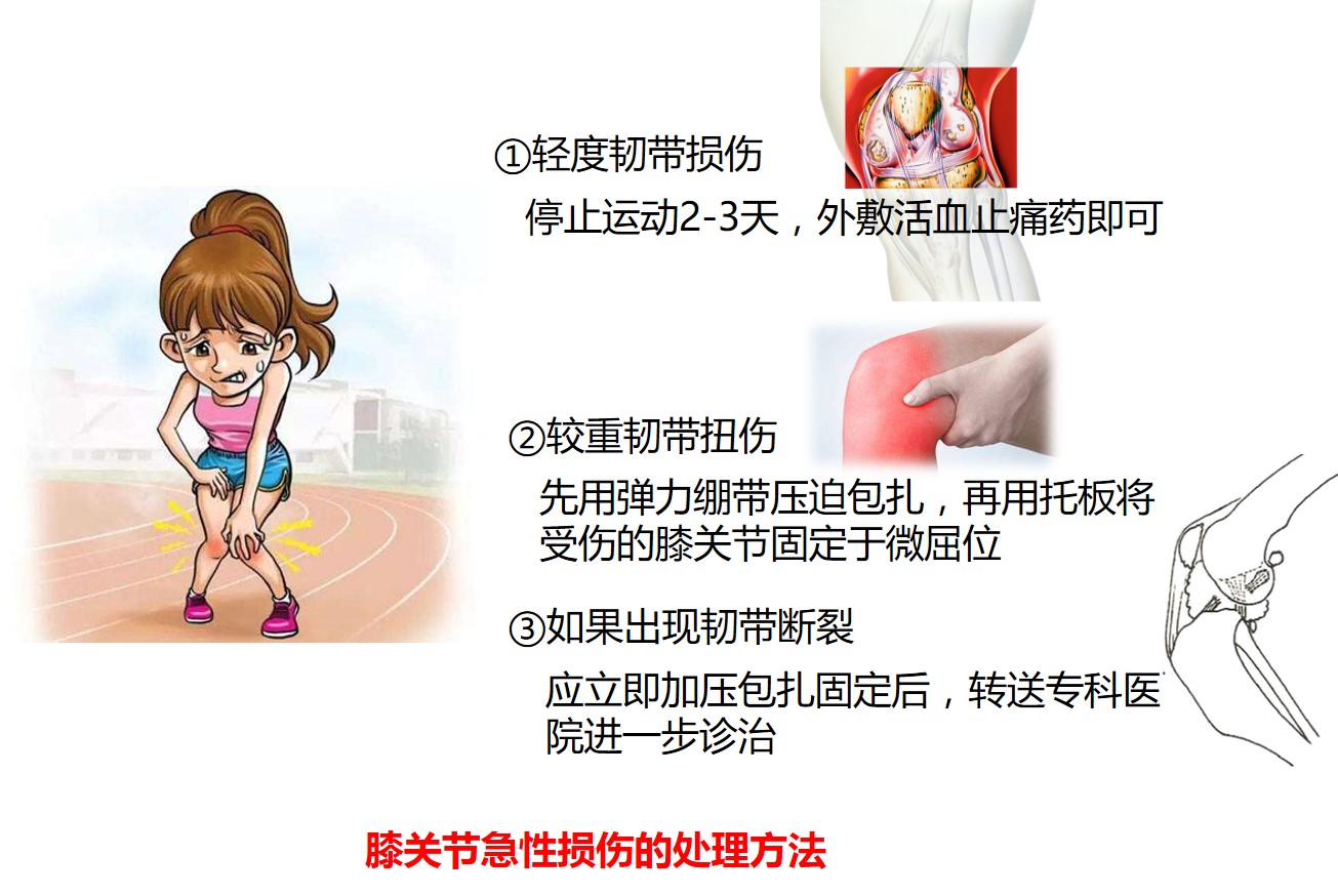 常见运动损伤及处理方法教案,怎样处理运动锻炼中常见的损伤