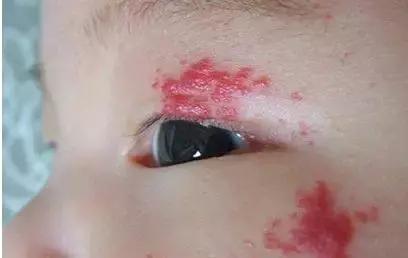 月嫂总结那些事：新生儿这28种情况是正常的