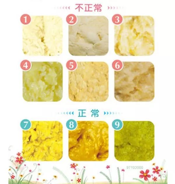 bb打完疫苗注意事项,宝妈刚生完宝宝注意事项