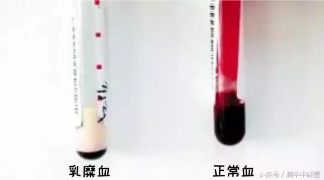 脂肪血是什么原因造成的,脂肪血怎么回事