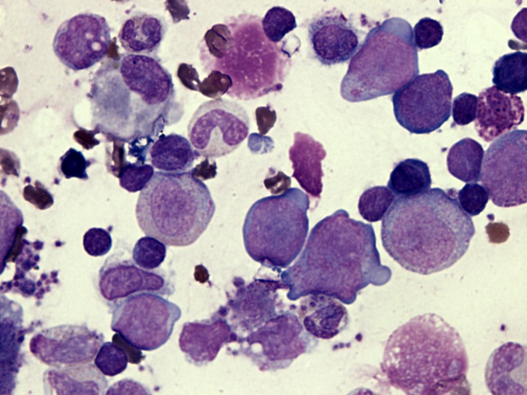 轻断食酵素和谷物粉,轻断食减脂营养粉