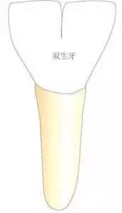 双牙重叠,连着两颗牙齿松动怎么办