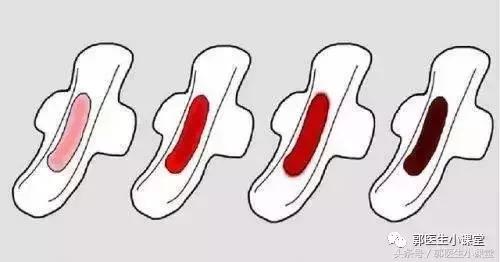 “姨妈”血发黑，需要排毒？