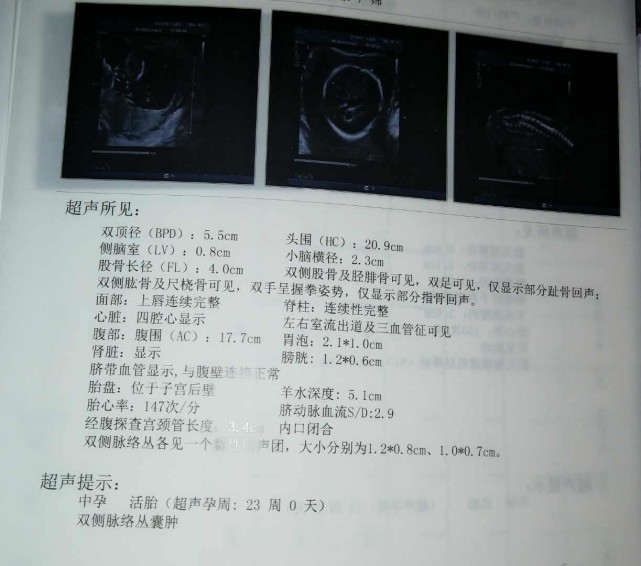 孕中期最明显的4个征兆,怀孕中期怎么判断胎宝的健康